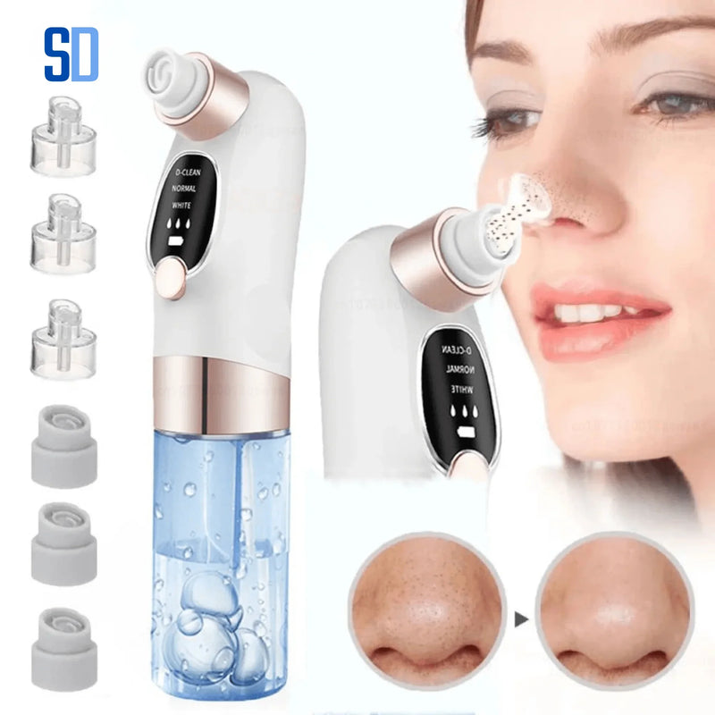 Removedor de Cravos Elétrico – Limpeza Profunda da Pele